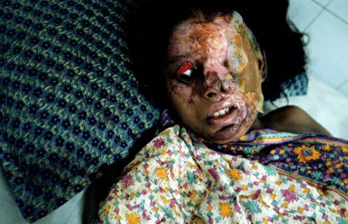 Muslim-acid-attack-09.jpg