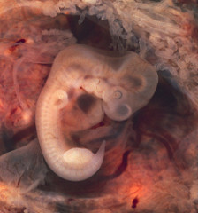 File:Human Embryo.jpg