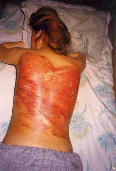File:Iranian-lesbian-flogged.jpg